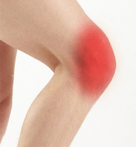 Anterior Knee pain