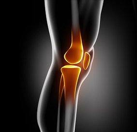 Revision Knee Replacement