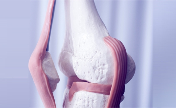 Knee Arthritis