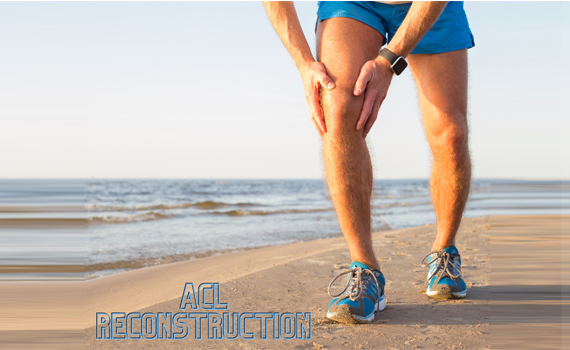 ACL Reconstruction